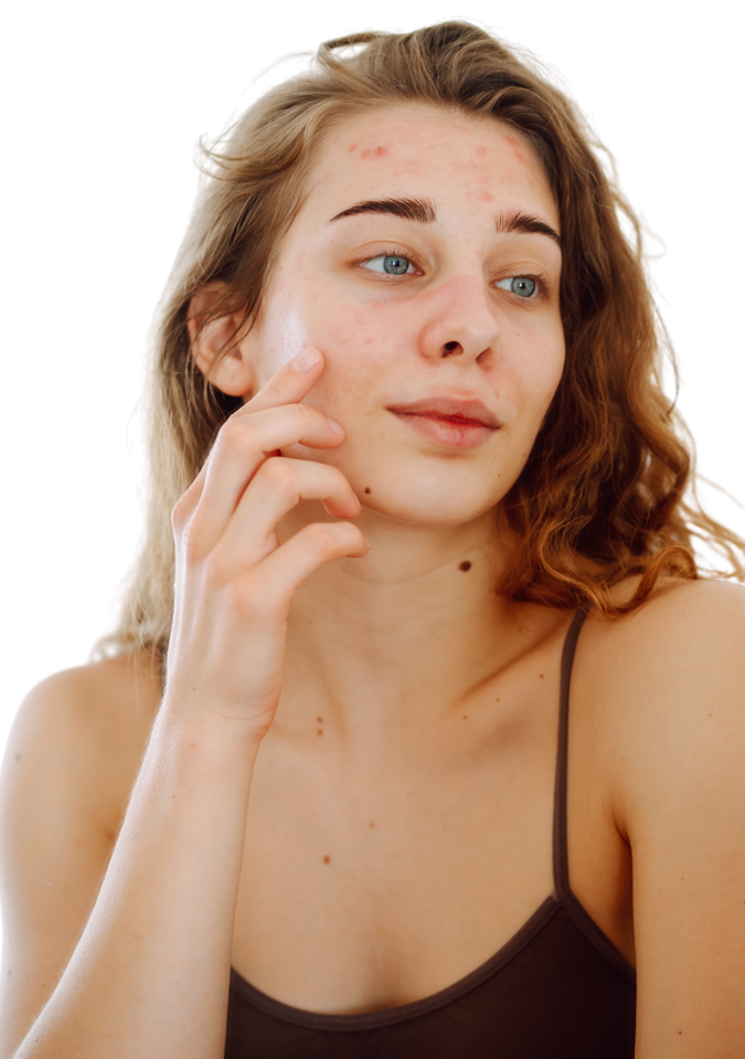Skin Tag Removal